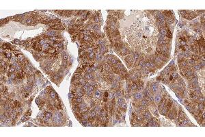 Immunohistochemistry (IHC) image for anti-Killer Cell Immunoglobulin-Like Receptor, three Domains, Long Cytoplasmic Tail, 1 (KIR3DL1) (Internal Region) antibody (ABIN6262823)