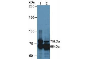 Western blot analysis of (1) Mouse Kidney Tissue and (2) Mouse Eye Tissue. (TGFBI 抗体  (AA 423-632))