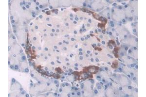 DAB staining on IHC-P; Samples: Rat Pancreas Tissue (UCP1 抗体  (AA 179-296))