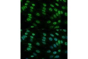 Immunofluorescence (IF) image for anti-Heterogeneous Nuclear Ribonucleoprotein M (HNRNPM) (AA 491-730) antibody (ABIN6141919)