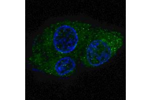 Fluorescent confocal image of HepG2 cells stained with FASN (Center) antibody. (Fatty Acid Synthase 抗体  (AA 942-973))