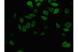 Immunofluorescence (IF) image for anti-Aldo-Keto Reductase Family 1, Member B1 (Aldose Reductase) (AKR1B1) (AA 114-230) antibody (ABIN7143701)