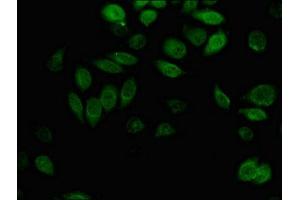 Immunofluorescent analysis of A549 cells using ABIN7143701 at dilution of 1:100 and Alexa Fluor 488-congugated AffiniPure Goat Anti-Rabbit IgG(H+L) (AKR1B1 抗体  (AA 114-230))