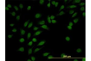 Immunofluorescence of monoclonal antibody to NR3C1 on HeLa cell. (Glucocorticoid Receptor 抗体  (AA 51-140))