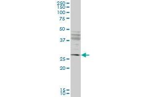 Western Blotting (WB) image for anti-Intraflagellar Transport 57 Homolog (IFT57) (AA 214-313) antibody (ABIN961309) (IFT57 抗体  (AA 214-313))