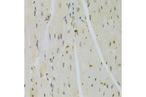 Immunohistochemistry of paraffin-embedded mouse heart using HMGB1 Antibody. (HMGB1 抗体  (AA 100-200))