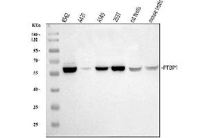 Western blot analysis of PTBP1 using anti-PTBP1 antibody (ABIN7599451).
