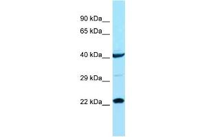 Host: Rabbit Target Name: ASCL1 Sample Type: COLO205 Whole cell lysates Antibody Dilution: 1. (ASCL1 抗体  (N-Term))
