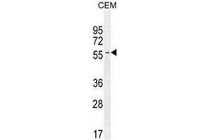 INHBA Antibody (N-term) western blot analysis in CEM cell line lysates (35µg/lane). (INHBA 抗体  (N-Term))