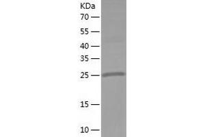Western Blotting (WB) image for Hydroxysteroid (17-Beta) Dehydrogenase 8 (HSD17B8) (AA 1-261) protein (His tag) (ABIN7123391) (HSD17B8 Protein (AA 1-261) (His tag))