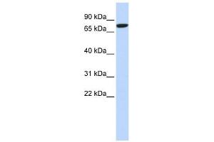 DLL1 antibody used at 1 ug/ml to detect target protein. (DLL1 抗体)