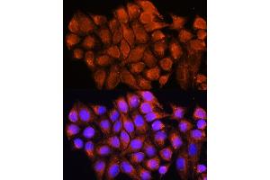 Immunofluorescence analysis of HeLa cells using D antibody (ABIN6129731, ABIN6137329, ABIN6137330 and ABIN6225254) at dilution of 1:100. (ATP5F1D 抗体  (AA 1-168))