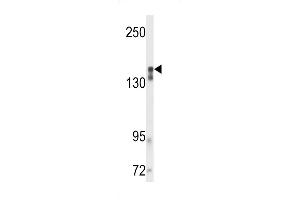 Western blot analysis of VGFR2 Antibody in mouse cerebellum tissue lysates (35ug/lane) (VEGFR2/CD309 抗体)