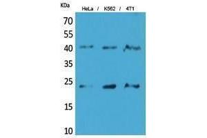 Western Blotting (WB) image for anti-Transmembrane Protein 173 (TMEM173) (C-Term) antibody (ABIN3178504) (STING/TMEM173 抗体  (C-Term))