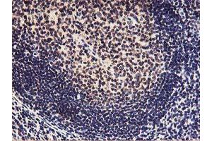 Immunohistochemical staining of paraffin-embedded Human tonsil using anti-HOXC11 mouse monoclonal antibody. (HOXC11 抗体  (AA 1-304))