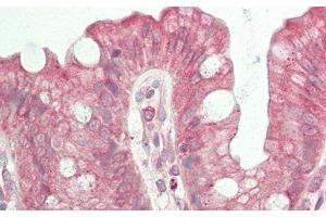Detection of Slit2 in Human Colon Tissue using Polyclonal Antibody to Slit Homolog 2 (Slit2)