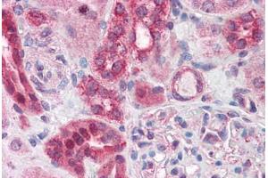 Human Kidney: Formalin-Fixed, Paraffin-Embedded (FFPE) (ABCD4 抗体  (AA 136-149))