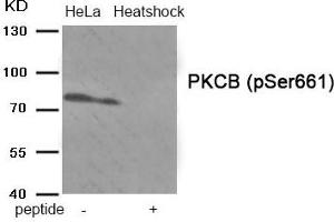 Western blot analysis of extracts from HeLa cells treated with Heatshock using Phospho-PKCB (Ser661) antibody. (PKC beta 抗体  (pSer661))