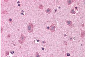 Human Brain, Cortex: Formalin-Fixed, Paraffin-Embedded (FFPE) (COPS8 抗体  (C-Term))