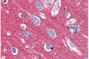 Anti-CADM2 antibody  ABIN1048369 IHC staining of human brain, cortex. (CADM2 抗体  (Internal Region))