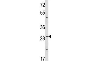 Western blot analysis of TTP antibody and WiDr lysate (ZFP36 抗体  (AA 116-142))