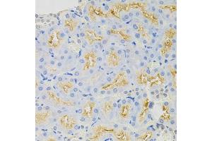Immunohistochemistry of paraffin-embedded rat kidney using SYK Antibody (ABIN5971150) at dilution of 1/100 (40x lens). (SYK 抗体)