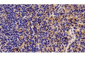 Detection of ANXA5 in Porcine Spleen Tissue using Polyclonal Antibody to Annexin V (ANXA5)