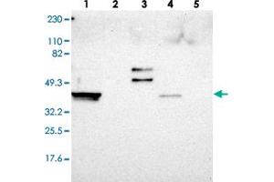 Western blot analysis of Lane 1: RT-4, Lane 2: U-251 MG, Lane 3: Human Plasma, Lane 4: Liver, Lane 5: Tonsil with ERICH1 polyclonal antibody  at 1:250-1:500 dilution. (ERICH1 抗体)