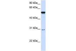 WB Suggested Anti-AIRE Antibody Titration:  0. (AIRE 抗体  (Middle Region))