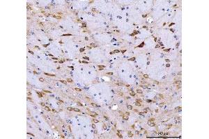 IHC analysis of SRGAP3 using anti-SRGAP3 antibody (ABIN7602538).