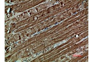 Immunohistochemical analysis of paraffin-embedded human-muscle, antibody was diluted at 1:200.