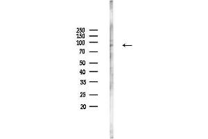 anti-Chromosome 7 Open Reading Frame 27 (C7orf27) antibody
