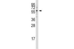 Western blot analysis of Tip60 antibody in Jurkat lysate (KAT5 抗体  (AA 33-64))