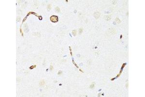 Immunohistochemistry of paraffin-embedded Rat brain using P Glycoprotein Polyclonal Antibody at dilution of 1:100 (40x lens). (P-Glycoprotein 抗体)