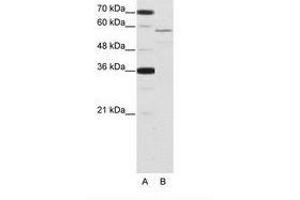 Image no. 1 for anti-Neuro-Oncological Ventral Antigen 2 (NOVA2) (AA 185-234) antibody (ABIN202652) (NOVA2 抗体  (AA 185-234))