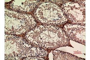 Immunohistochemistry (IHC) analysis of paraffin-embedded Mouse Ovary, antibody was diluted at 1:100.
