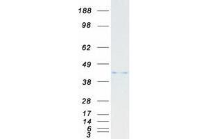 Western Blotting (WB) image for Proteasome (Prosome, Macropain) 26S Subunit, ATPase, 6 (PSMC6) protein (Myc-DYKDDDDK Tag) (ABIN2729971)