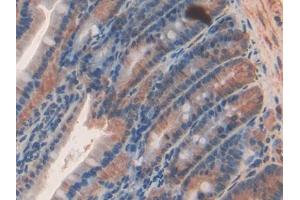 DAB staining on IHC-P; Samples: Rat Intestine Tissue (SEMA3A 抗体  (AA 31-150))