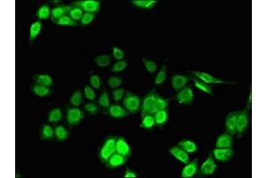 Immunofluorescent analysis of PC-3 cells using ABIN7156631 at dilution of 1:100 and Alexa Fluor 488-congugated AffiniPure Goat Anti-Rabbit IgG(H+L) (IRF7 抗体  (AA 131-289))