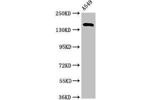 Western Blot Positive WB detected in: A549 whole cell lysate All lanes: A2ML1 antibody at 3. (A2ML1 抗体  (AA 625-751))