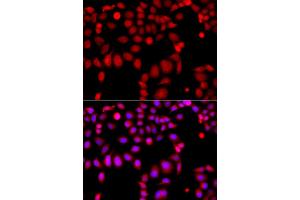 Immunofluorescence analysis of A549 cells using ARHGEF9 antibody (ABIN5975759). (Arhgef9 抗体)