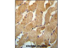 NDUFAF2 Antibody (Center) (ABIN657264 and ABIN2846359) immunohistochemistry analysis in formalin fixed and paraffin embedded human skeletal muscle followed by peroxidase conjugation of the secondary antibody and DAB staining. (NDUFAF2 抗体  (AA 71-99))