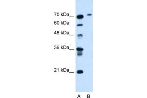 Western Blotting (WB) image for anti-Butyrylcholinesterase (BCHE) antibody (ABIN2462791) (Butyrylcholinesterase 抗体)