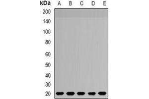 Western blot analysis of NDUFS4 expression in SW620 (A), MCF7 (B), HepG2 (C), mouse brain (D), rat liver (E) whole cell lysates. (NDUFS4 抗体)