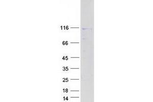 Western Blotting (WB) image for N(alpha)-Acetyltransferase 25, NatB Auxiliary Subunit (NAA25) protein (Myc-DYKDDDDK Tag) (ABIN2725701)