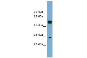 SLA1 antibody used at 1 ug/ml to detect target protein.