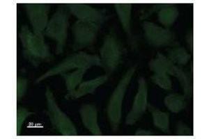 Immunostaining analysis in HeLa cells. (STK3 抗体)