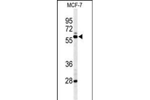 Western blot analysis of NR1H3 Antibody (Center) (ABIN653910 and ABIN2843147) in MCF-7 cell line lysates (35 μg/lane). (NR1H3 抗体  (AA 226-253))