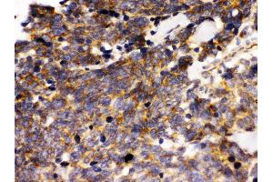 Immunohistochemistry (IHC) image for anti-Protein Tyrosine Phosphatase Receptor Type F (PTPRF) (AA 1167-1203), (Middle Region) antibody (ABIN3043915)