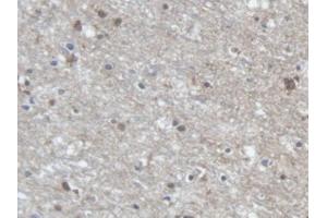 DAB staining on IHC-P; Samples: Human Cerebrum Tissue (PCDHA1 抗体  (AA 30-242))